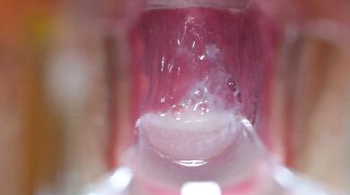 FC2-PPV-4208709 ZIP Bonus Included [None] Beautiful Girl Idol Slender Hina 20 Years Old Sexy Cosplay Two Rounds in Missionary and Doggy Style Vaginal Observation with Speculum After Creampie Cleanup Blowjob Included 15th Work [Sakai]